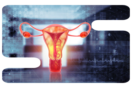 Gynae PCD Company in India